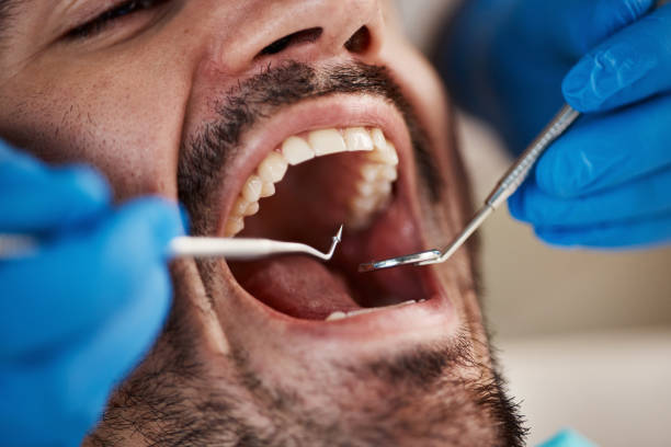 Best Dentist Open Late Near Me  in Otis Orchards East Farms, WA